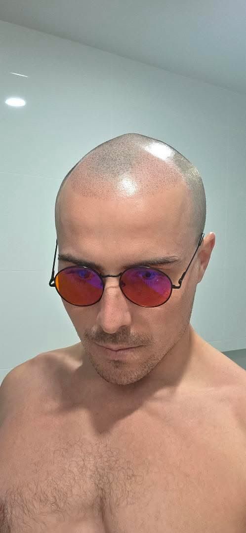 Confident male client with completed SMP